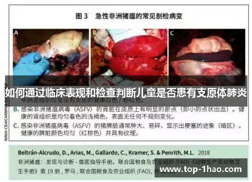 如何通过临床表现和检查判断儿童是否患有支原体肺炎